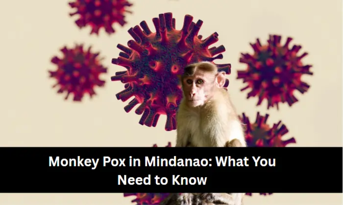 Monkey pox in Mindanao